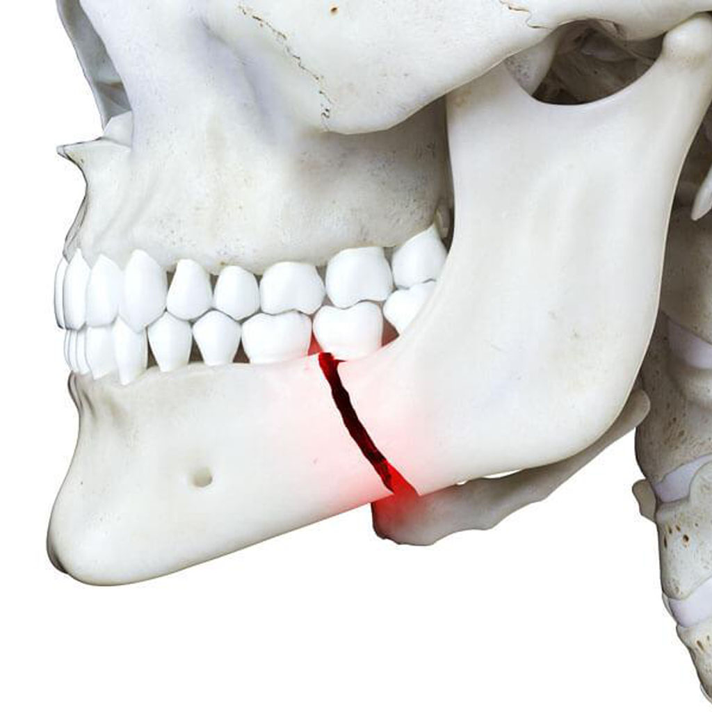 Trauma Facial